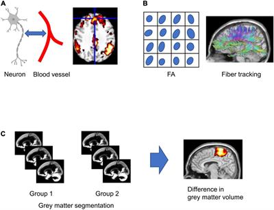 Translational Magnetic Resonance Imaging in Autism Spectrum Disorder From the Mouse Model to Human